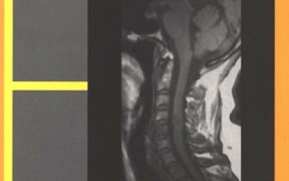 Anatomía de la médula espinal, nueva publicación del CDCH-UCV